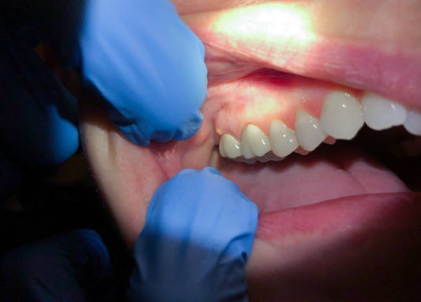 Best Emergency Orthodontic Repairs in Byhalia, MS