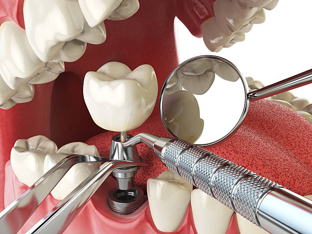 Best After-Hours Emergency Dentist in Byhalia, MS